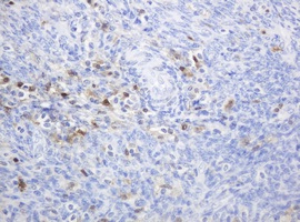 Immunohistochemical analysis of paraffin embedded Human lymph node tissue labelling Thymidine Phosphorylase with ab140786 at a 1/150 dilution. 