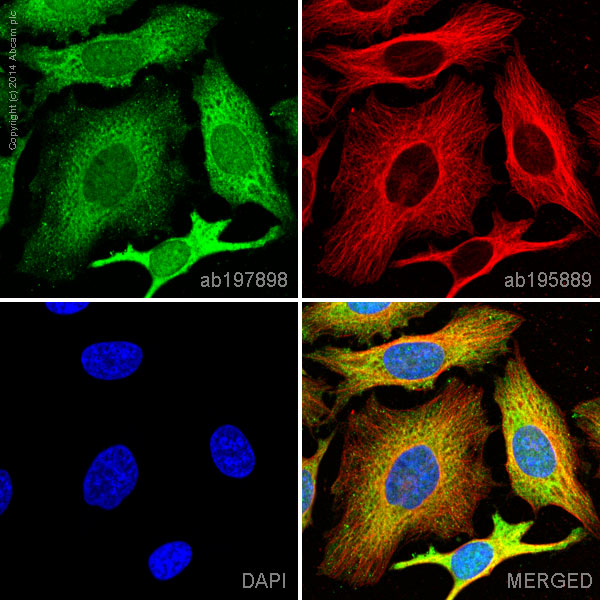 ab197898 staining Thymidylate Synthase in HeLa cells. The cells were fixed with 100% methanol (5 min), permeabilized with 0.1% Triton X-100 for 5 minutes and then blocked with 1% BSA/10% normal goat serum/0.3M glycine in 0.1%PBS-Tween for 1h. The cells were then incubated overnight at +4°C with ab197898 at a 1/100 dilution (shown in green) and ab195889, Mouse monoclonal to alpha Tubulin (Alexa Fluor® 594), at a 1/250 dilution (shown in red). Nuclear DNA was labelled with DAPI (shown in blue).Image was taken with a confocal microscope (Leica-Microsystems, TCS SP8).