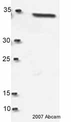 Anti-Thymidylate Synthase antibody [TS 106] (ab3145) at 1 µg/ml + HL60 whole cell lysate at 20 µgSecondaryHRP conjugated sheep F(ab') anti-mousedeveloped using the ECL techniquePerformed under reducing conditions.
