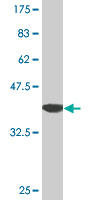 Anti-Thymosin alpha 1 antibody (ab76557) at 5 µg/ml + immunizing immunogen at 0.2 µgSecondaryGoat Anti-Mouse IgG (H&L)-HRP Conjugate secondary antibody at 1/5000 dilution