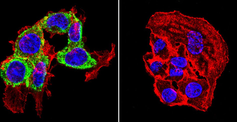Immunocytochemistry/Immunofluorescence analysis of Thyroid Hormone Receptor in HepG2 cells. Cells were grown on chamber slides and fixed with formaldehyde prior to staining. Cells were probed without (control) or with ab2743 (1:20) overnight at 4°C, washed with PBS and incubated with a DyLight-488 conjugated secondary antibody. Thyroid Hormone Receptor staining (green), F-Actin staining with Phalloidin (red) and nuclei with DAPI (blue) is shown. Images were taken at 60X magnification.