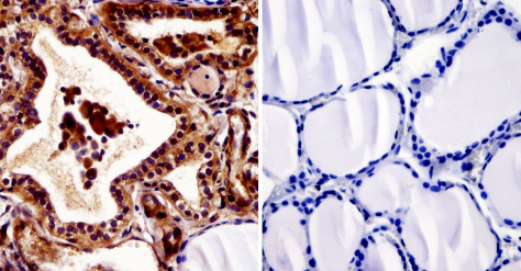 Immunohistochemistry (Formalin/PFA-fixed paraffin-embedded sections) was performed on normal biopsies of deparaffinized human thyroid tissue. Heat induced antigen retrieval was performed using 10mM sodium citrate (pH6.0) buffer, microwaved for 8-15 minutes. Tissues were blocked in 3% BSA-PBS for 30 minutes at room temperature and probed with ab2743 (1:20) or without primary antibody (negative control) overnight at 4°C in a humidified chamber. Tissues were washed with PBST and endogenous peroxidase activity was quenched with a peroxidase suppressor. Detection was performed using a biotin-conjugated secondary antibody and SA-HRP, followed by colorimetric detection using DAB. Tissues were counterstained with hematoxylin and prepped for mounting.