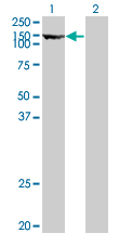 All lanes : Anti-Thyroid Peroxidase antibody (ab76935) at 5 µg/mlLane 1 : Transfected 293T cell lysateLane 2 : Untransfected 293T cell lysateLysates/proteins at 50 µg per lane.SecondaryGoat Anti-Mouse IgG (H&L)-HRP Conjugate at 1/5000 dilutiondeveloped using the ECL technique