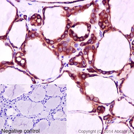Immunohistochemical staining of paraffin embedded human thyroid with purified ab133322 at a working dilution of 1 in 1000. The secondary antibody used is a HRP polymer for rabbit IgG. The sample is counter-stained with hematoxylin. Antigen retrieval was perfomed using Tris-EDTA buffer, pH 9.0. PBS was used instead of the primary antibody as the negative control, and is shown in the inset.