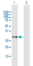 All lanes : Anti-Thyrotropin Releasing Hormone (TRH) antibody (ab167662) at 1 µg/mlLane 1 : Thyrotropin Releasing Hormone (TRH) transfected 293T cell lysate Lane 2 : Non-transfected 293T cell lysate Lysates/proteins at 15 µl per lane.SecondaryGoat Anti-Mouse IgG at 1/2500 dilutiondeveloped using the ECL technique
