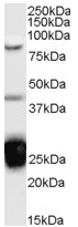 Anti-TIA1 antibody (ab61700) at 0.1 µg/ml + Jurkat cell lysate (35µg protein in RIPA buffer).