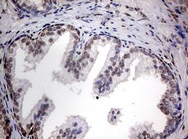 Immunohistochemical analysis of paraffin-embedded Human prostate tissue labeling TIA1 with ab170156 at 1/150 dilution.