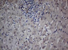Immunohistochemical analysis of paraffin-embedded Human liver tissue labeling TIA1 with ab170156 at 1/150 dilution.