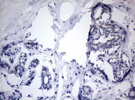 Immunohistochemical analysis of paraffin-embedded Human breast tissue labeling TIA1 with ab170156 at 1/150 dilution.