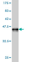Western blot against tagged recombinant protein immunogen using ab57033 TIAM2 antibody at 1ug/ml.