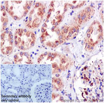 Immunohistochemical analysis of paraffin-embedded Human testis tissue labeling TIAM2 with ab199426 at 1/500 dilution followed by Goat Anti-Rabbit IgG H&L (HRP) (ab97051) at 1/500 dilution. Cytoplasm staining on Human testis tissue is observed. Counter stained with Hematoxylin.Negative control: Used only secondary antibody.