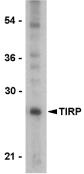 Anti-TICAM2 antibody (ab17221) at 1 µg/ml + PC-3 cell lysate
