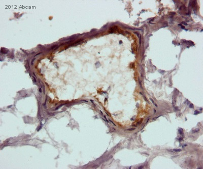 Immunohistochemical analysis of Human brain tissue, staining TIE2 with ab24859.Tissue was fixed with paraformaldehyde, permeabilized with 0.25 Triton X-100 and blocked with 2.5% BSA for 30 minutes at 25°C. Samples were incubated with primary antibody (1/200 in 2.5% horse serum) for 18 hours at 4°C. An HRP-conjugated horse anti-rabbit polyclonal IgG was used as the secondary antibody. See Abreview