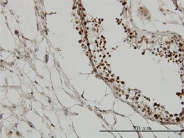 TIF1 gamma antibody (ab57172) used in immunohistochemistry at 3ug/ml on formalin fixed and paraffin embedded human testis.