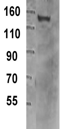Anti-TIF1 gamma antibody [16G9] (ab33475) at 2 µg/ml + Recombinant TIF1 gamma at 20 µg