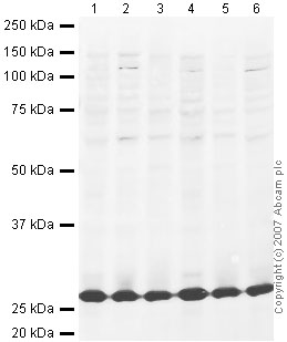 All lanes : Anti-TIGAR antibody (ab37910) at 1/250 dilutionLane 1 : HeLa (Human epithelial carcinoma cell line) Whole Cell LysateLane 2 : Jurkat (Human T cell lymphoblast-like cell line) Whole Cell Lysate (ab7899)Lane 3 : A431 (Human epithelial carcinoma cell line) Whole Cell Lysate (ab7909)Lane 4 : HEK293 (Human embryonic kidney cell line) Whole Cell Lysate (ab7902)Lane 5 : HepG2 (Human hepatocellular liver carcinoma cell line) Whole Cell Lysate (ab7900)Lane 6 : MCF-7 (Human breast adenocarcinoma cell line) Whole Cell LysateLysates/proteins at 10 µg per lane.SecondaryIRDye 680 Conjugated Goat Anti-Rabbit IgG (H+L) at 1/10000 dilutionPerformed under reducing conditions.