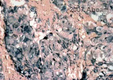 ab37910 staining human adrenal tissue sections by IHC-P.  Sections were PFA fixed and subjected to heat mediated antigen retrieval in citrate buffer (pH 6) prior to blocking in 10% serum for 1 hour at 25°C.  The primary antibody was diluted 1/200 and incubated with the sample for 1 hour at 25°C.  A biotinylated goat anti-rabbit antibody diluted 1/400 was used as the secondary.See Abreview