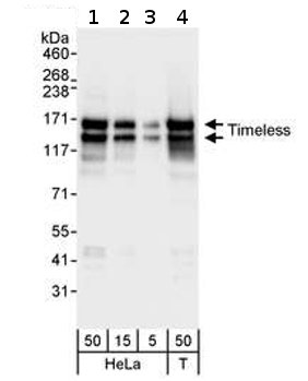 All lanes : Anti-Timeless antibody (ab72458) at 0.04 µg/mlLane 1 : HeLa whole cell lysate at 50 µgLane 2 : HeLa whole cell lysate at 15 µgLane 3 : HeLa whole cell lysate at 5 µgLane 4 : 293T whole cell lysate at 50 µg