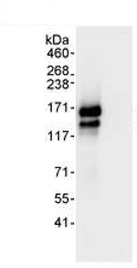 HeLa whole cell lysate, (1 mg for IP, 20% of IP loaded) with ab 72458 used for IP at 3 µg/mg lysate, and for subsequent WB at 0.1 µg/ml. Detection: Chemiluminescence with an exposure time of 3 seconds.