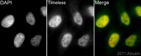 ab72458 (1/200) staining Timeless in assynchronous HeLa cells (green). Cells were fixed in paraformaldehyde, permeabilized with 0.5% Triton X-100 and counterstained with DAPI in order to highlight the nucleus (red). Please refer to abreview for further experimental details.See Abreview