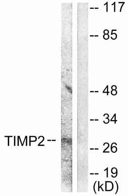 All lanes : Anti-TIMP2 antibody (ab53730) at 1/500 dilutionLane 1 : A549 cell extractLane 2 : A549 cell extract with immunising peptide