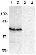All lanes : Anti-Silencer of Death Domain antibody (ab2048) at 1/500 dilutionLane 1 : HeLa whole cell lysate with absence of blocking peptideLane 2 : THP-1 whole cell lysate with absence of blocking peptideLane 3 : HeLa whole cell lysate with Silencer of Death Domain peptide (ab8382)Lane 4 : THP-1 whole cell lysate with Silencer of Death Domain peptide (ab8382)Observed band size : 60 kDa (why is the actual band size different from the predicted?)