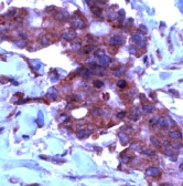 ab15560 staining TIMP2 in human colon tissue section by Immunohistochemistry (Formalin/ PFA fixed paraffin-embedded tissue sections).