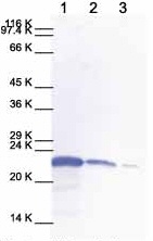 All lanes : Anti-TIMP2 antibody - Loop 2 (ab28260)Lane 1 : Human TIMP2Lane 2 : Mouse TIMP2Lane 3 : Cell media from human chondrosarcoma (untreated)