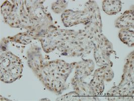 TIP120A antibody (ab57658) used in immunohistochemistry at 3ug/ml on formalin fixed and paraffin embedded human placenta.