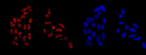 Immunofluorescent analysis of HeLa cells (-20℃ Acetone-fixed) labeling TIP120A with ab181216 at 1/250 dilution followed by Goat anti rabbit IgG (Alexa Fluor® 555) at 1/200 dilution and counterstained with Dapi (blue).