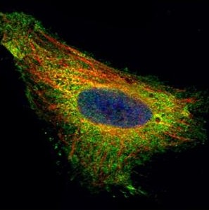 Confocal Immunofluorescence analysis of paraformaldehyde-fixed HeLa, labeling TIP30 using ab192775 at a 1/500 diluition (Green). Alpha-tubulin filaments were labeled with alpha-tubulin antibody (Red) at 1/2000.