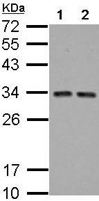 All lanes : Anti-TIP30 antibody (ab192775) at 1/5000 dilutionLane 1 : A431 whole cell lysateLane 2 : HeLa whole cell lysateLysates/proteins at 30 µg per lane.