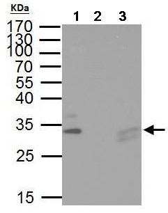 Western blot analysis of TIP30 in immunoprecipitation pellets from 40 µg HeLa whole cell lysate. ab192775 used at 1/1000 dilution (Lane 1). Negative control with 2 µg of preimmune rabbit IgG (Lane 2). Immunoprecipitation of TIP30 protein by 2 µg of TIP30 antibody (Lane 3). 10% SDS-PAGE.