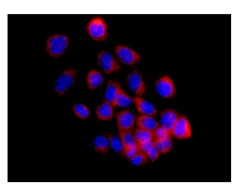 Immunofluorescence analysis of A431 cells labeling TIP30 using ab177961 at 1/50 dilution.