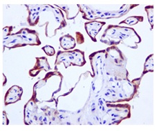 Immunohistochemical analysis of Human placenta tissue labeling TIP30 using ab177961 at 1/50 dilution.