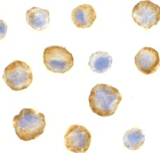 ab2048 at 5µg/ml staining Silencer of Death Domain in Hela cells by ICC/IF