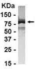 Anti-TIP49A antibody (ab37754) at 1/2000 dilution + E coli derived fusion protein at 2.5 µgSecondaryGoat anti IgY HRP at 1/1000 dilution