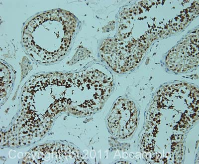 IHC image of ab51500 staining in human normal testis formalin fixed paraffin embedded tissue section, performed on a Leica BondTM system using the standard protocol F. The section was pre-treated using heat mediated antigen retrieval with sodium citrate buffer (pH6, epitope retrieval solution 1) for 20 mins. The section was then incubated with ab51500, 5µg/ml, for 15 mins at room temperature and detected using an HRP conjugated compact polymer system. DAB was used as the chromogen. The section was then counterstained with haematoxylin and mounted with DPX.For other IHC staining systems (automated and non-automated) customers should optimize variable parameters such as antigen retrieval conditions, primary antibody concentration and antibody incubation times.