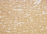 ab17218 at 2µg/ml staining TIRAP in human heart cells by IHC