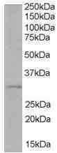 Anti-TIRAP antibody (ab1349) at 1 µg/ml + Human Liver lysate (35ug protein in RIPA buffer)