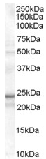 Anti-TIRAP antibody (ab47986) at 0.1 µg/ml + K562 cell lysate (35µg protein in RIPA buffer).