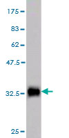 Western blot against tagged recombinant protein immunogen using ab57886 TKTL2 antibody at 1ug/ml.
