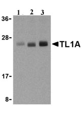 Lane 1 :  Anti-TL1A antibody (ab21272) at 0.5 µg/mlLane 2 :  Anti-TL1A antibody (ab21272) at 1 µg/mlLane 3 :  Anti-TL1A antibody (ab21272) at 2 µg/mlLane 1 : PC-3 cell lysate Lane 2 : PC-3 cell lysate Lane 3 : PC-3 cell lysate