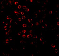 Immunofluorescence of SODD in Hela cells using ab2048 at 20 ug/ml.