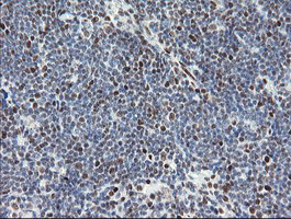 Immunohistochemical analysis of paraffin-embedded Human lymphoma tissue labelling TLE1 with ab131648 at 1/150 dilution.