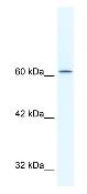 Anti-TLE3 antibody (ab32992) at 1/2.5 dilution + HepG2 cell lysateSecondary HRP conjugated anti Rabbit IgG at 1/50000 dilution