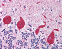 ab115598, at 5µg/ml, staining TLR10 in Formalin-fixed, Paraffin-embedded Human brain cerebellum tissue by Immunohistochemistry followed by biotinylated secondary antibody, alkaline phosphatase-streptavidin and chromogen.