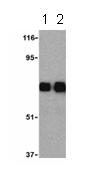 Lane 1 :  Anti-TLR10 antibody (ab21273) at 0.5 µg/mlLane 2 :  Anti-TLR10 antibody (ab21273) at 1 µg/mlLane 1 : Human lymph node cell lysatesLane 2 : Human lymph node cell lysates