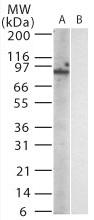 Lane 1 :  Anti-TLR11 antibody [15F1215] (ab22051) at 1/1000 dilutionLane 2 :  Untransfected cell lysate.Lane 1 : As aboveLane 2 : As abovePerformed under reducing conditions.