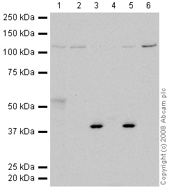 All lanes : Anti-TLR13 antibody (ab60789) at 1 µg/mlLane 1 : Brain (Mouse) Tissue LysateLane 2 : Testis (Mouse) Tissue Lysate - normal tissueLane 3 : Liver (Mouse) Tissue Lysate - normal tissueLane 4 : Heart (Mouse) Tissue LysateLane 5 : Kidney (Mouse) Tissue LysateLane 6 : NIH 3T3 (Mouse embryonic fibroblast cell line) Whole Cell Lysate (ab7179)Lysates/proteins at 10 µg per lane.SecondaryGoat polyclonal to Rabbit IgG - H&L - Pre-Adsorbed (HRP) at 1/3000 dilutionPerformed under reducing conditions.